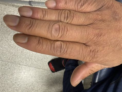 An Aid To The Mrcp Short Cases 7
