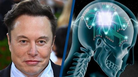 Video Elon Musk Owned Neuralinks Brain Implant Trials Draw Myriad