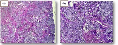 Hematoxylin Eosin H E Stained Section Showed Typical Naked