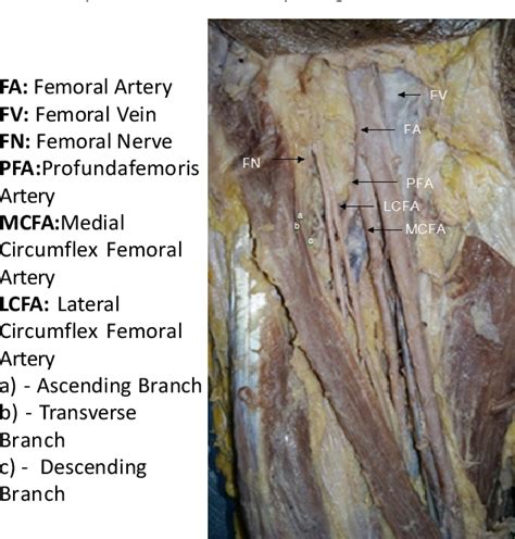 Femoral Artery And Its Branches