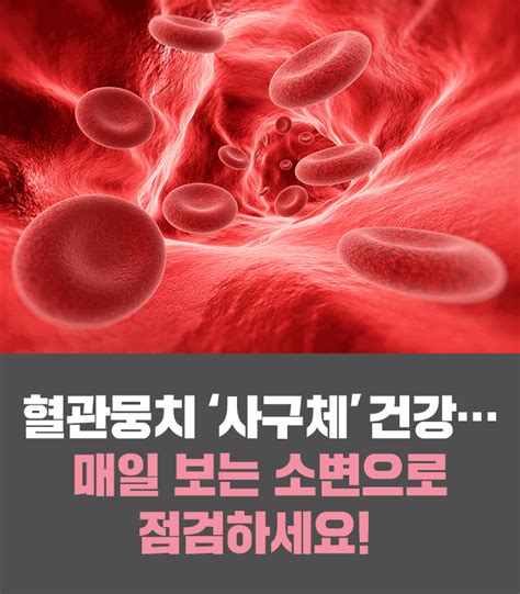 혈관뭉치 ‘사구체 건강…매일 보는 소변으로 점검하세요 네이버 포스트