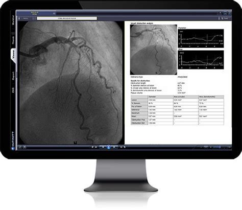 Pacs Per Diagnostica Per Immagini Infinitt Healthcare Basato Sul Web