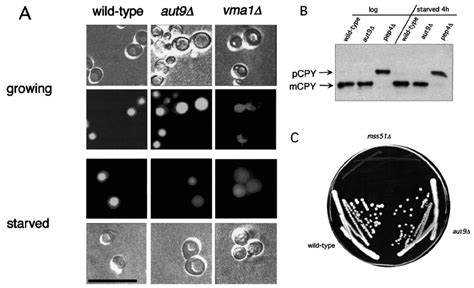 A Accumulation Of Quinacrine In The Vacuoles Of Growing And Starved