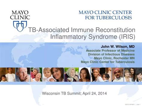 Ppt Tb Associated Immune Reconstitution Inflammatory Syndrome Iris