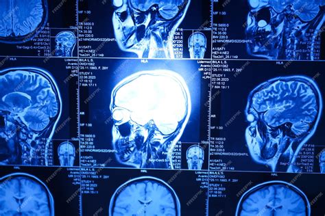 Premium Photo | MRI or magnetic resonance imaging of the head and brain