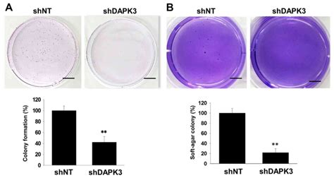 Soft Agar Colony Formation Assay Crystal Violet