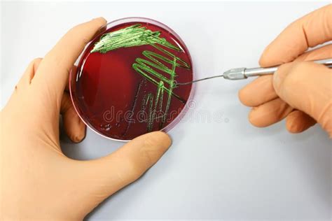 Microbiology Science - Bacteria Culture Stock Photo - Image of plate, culture: 22623064