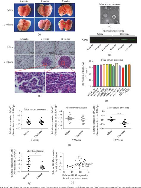 Figure 1 From Low Long Noncoding Rna Growth Arrest Specific Transcript