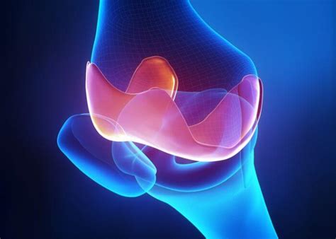 Osteochondral Allograft Transplantation Oca Transplant Orthopedic