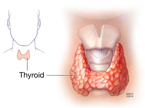 Thyroid Nodules Symptoms And Causes Mayo Clinic