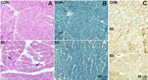 Figure 2 From Mutations In INPP5K Cause A Form Of Congenital Muscular