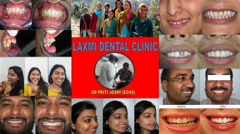 Photo Gallery Laxmi Dental Clinic In Kaladhungi Road Mukhani