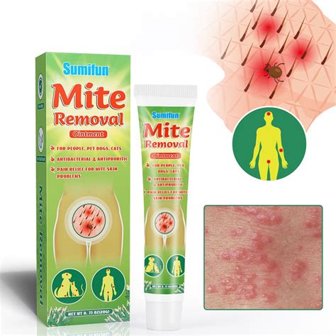 Anti Mite Ointment Adult Antipruritic Topical Solution For Pubic Lice