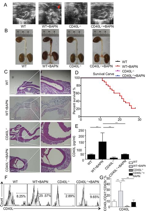 Cd L Promotes Development Of Acute Aortic Dissection Via Induction Of