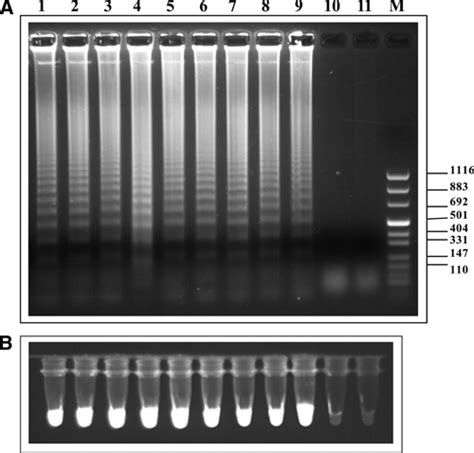 Detection Of Schistosoma Mansoni And Schistosoma Haematobium Dna By Loop Mediated Isothermal