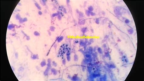 Candida glabrata: Introduction, Morphology, Pathogenicity, Lab