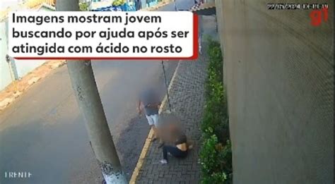 Jovem Atacada Cido Enquanto Ia Para Academia No Paran E Fica Em