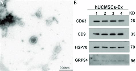 The Membrane Structure Of The Hucmsc Derived Exosomes Under Download Scientific Diagram