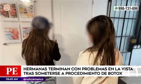 Los Olivos Hermanas Con Problemas En Ojos Tras Tratamiento