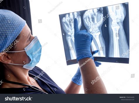 Orthopaedic Surgeon Studying Xray Broken Radius Stock Photo