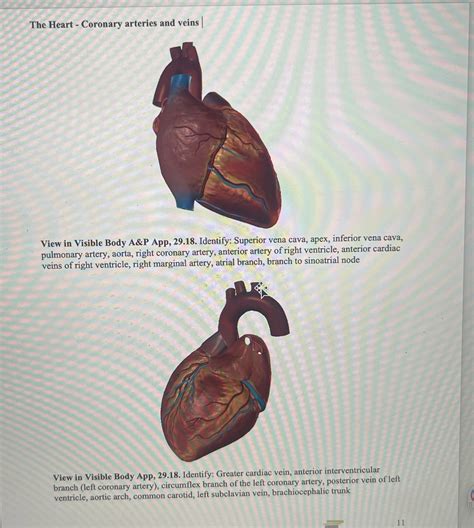 [Solved] Anatomy and physiology. The Heart - Coronary arteries and ...