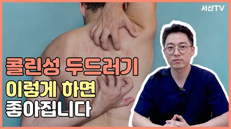 콜린성 두드러기 체온 상승을 막아야 합니다 스트레스 운동 요리 더위 한의사 서산 Youtube