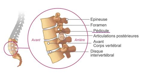 P Dicule Vert Bral D Finition Et Anatomie