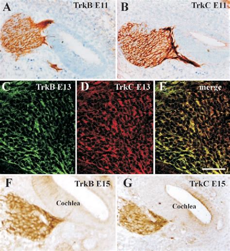 Pdf Spatial Shaping Of Cochlear Innervation By Temporally Regulated