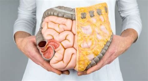 Intestinal Cancer Symptoms | CNC Health Info