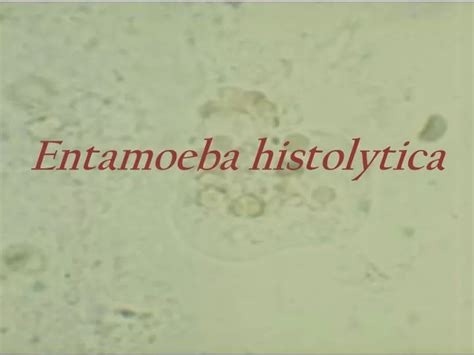 Ppt Entamoeba Histolytica Powerpoint Presentation Free Download Id1084160