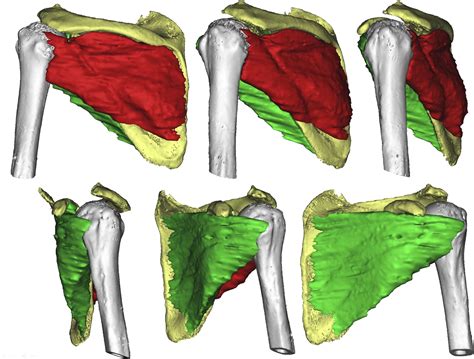 Evaluation Of The Muscle Volumes Of The Transverse Rotator Cuff Force Couple In Nonpathologic