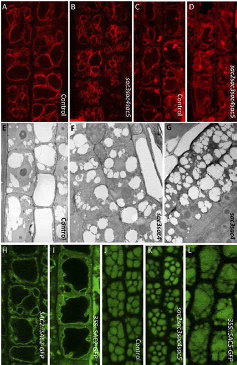 Aberrant Vacuolar Morphology In Sac Mutants A And B Epidermal Cells