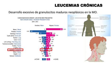 LEUCEMIAS AGUDAS Y CRÓNICAS PPT