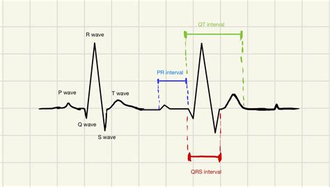 [solved] Draw And Label An Ecg Tracing For A Normal Sinus Rhythm And Label Course Hero