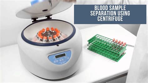separation  blood components  centrifuge youtube