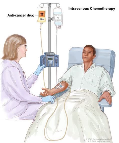 Definition of intravenous chemotherapy - NCI Dictionary of Cancer Terms ...