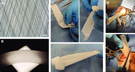 Double Layer Scaffold For Hernia Repair Device A Bilayer Scaffold