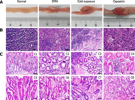 Pathological Observation And Lymph Node Metastases Of Different Groups Download Scientific