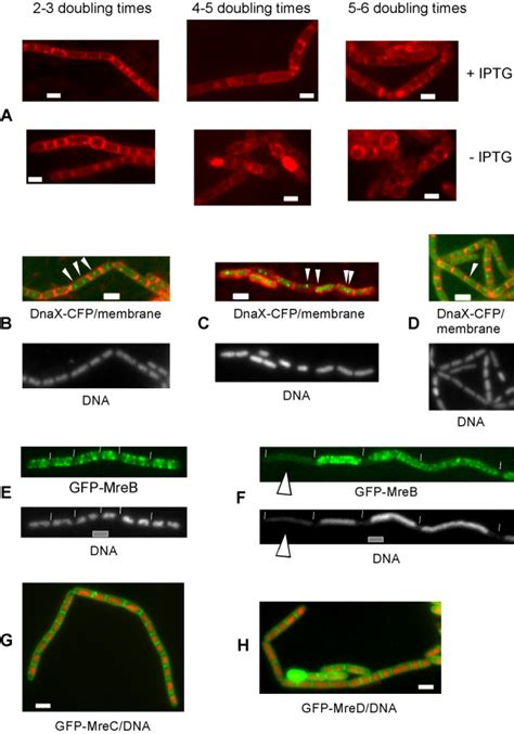 Depletion Of Mreb In The Presence Of Mrec And Of Mred Affects Both Cell