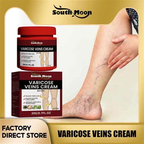 South Moon Varicose Veins Relief Cream Vasculitis Phlebitis Spider Pain