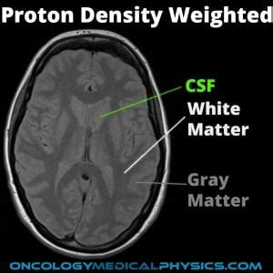 MRI Contrast Weighting Oncology Medical Physics