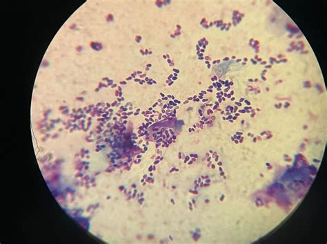 Cytologie Cytologick Vy Et En Uveterinarky Cz