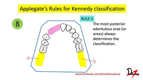 Kennedys Classification Applegates Rules English Youtube