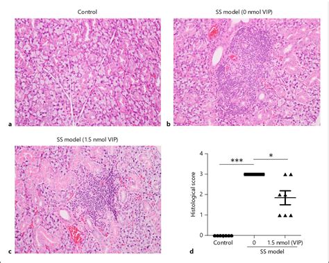 Figure From Vasoactive Intestinal Peptide Protects Salivary Glands