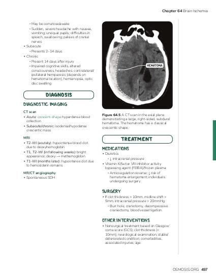 Subdural Vs Epidural Hematoma BheinnFarhana