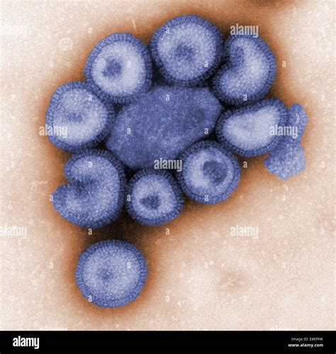 This Colorized Negative Stained Transmission Electron Micrograph Tem