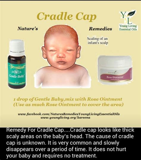 What Is the Best Treatment for Cradle Cap