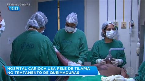 Rj Hospital Souza Aguiar Utiliza Pele De Til Pia Para Tratar