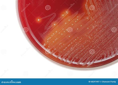 Estreptococo Colonias Bacterianas Con Hemolítico Beta En Sangre AG