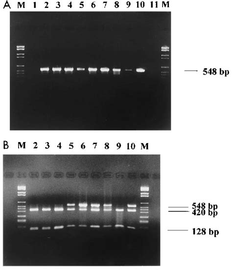 Agarose Gel Electrophoresis Of Pcr Products A And The Corresponding